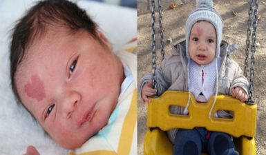 Μωράκι γεννήθηκε με ένα σημάδι σε σχήμα καρδιάς -Πηγή: athensmagazine.gr